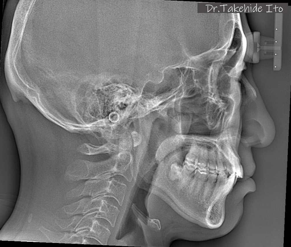 歯歯科英語オンラインセミナー