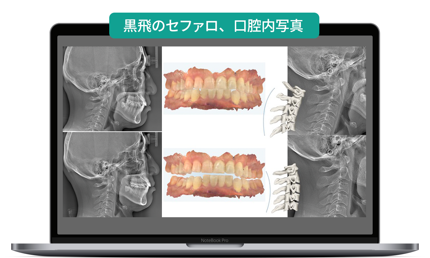 歯歯科英語オンラインセミナー